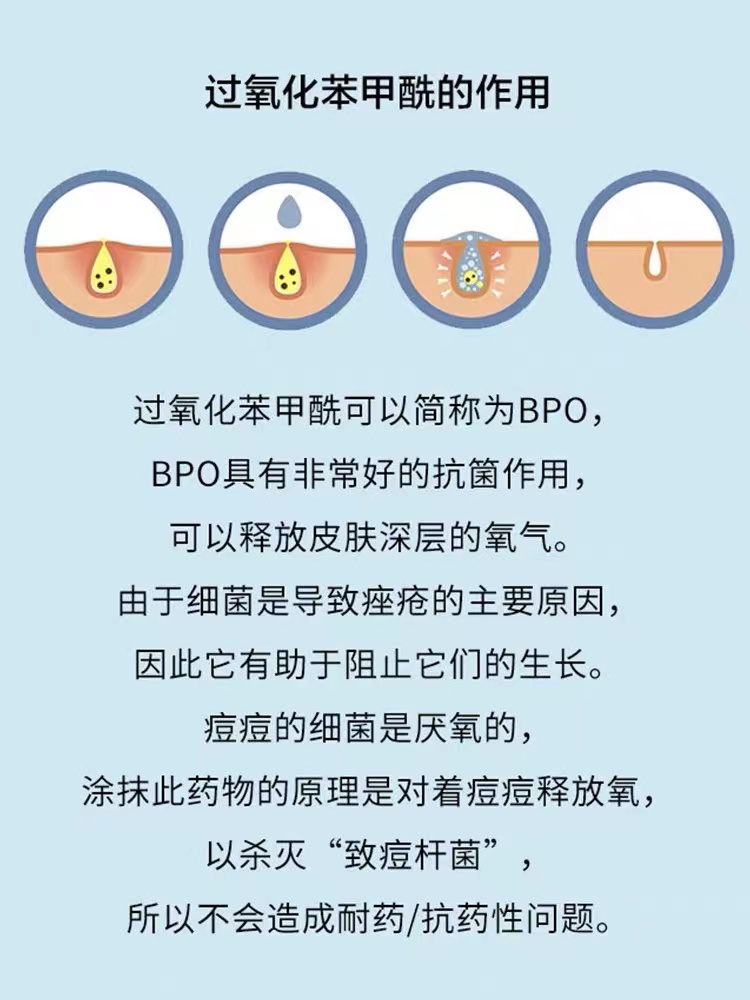 美国PanOxyl洗面奶10%过氧化苯甲酰深层祛痘疏通毛孔清洁面乳156g