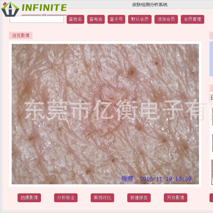 美容院面部UV皮肤检测仪，肤质分析仪, 3D智能皮膜检测试仪器