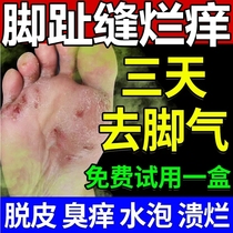 Treat the feet and piste off the skin to remove root white vinegar feet gas toe slit water to soak in the special medicine