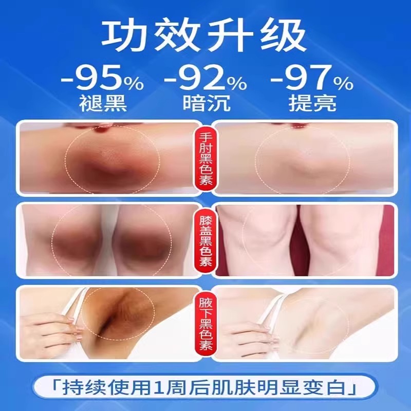 晒黑了皮肤晒伤儿童军训晒后修复霜快速变白身体乳脸脖子美白专用 - 图1