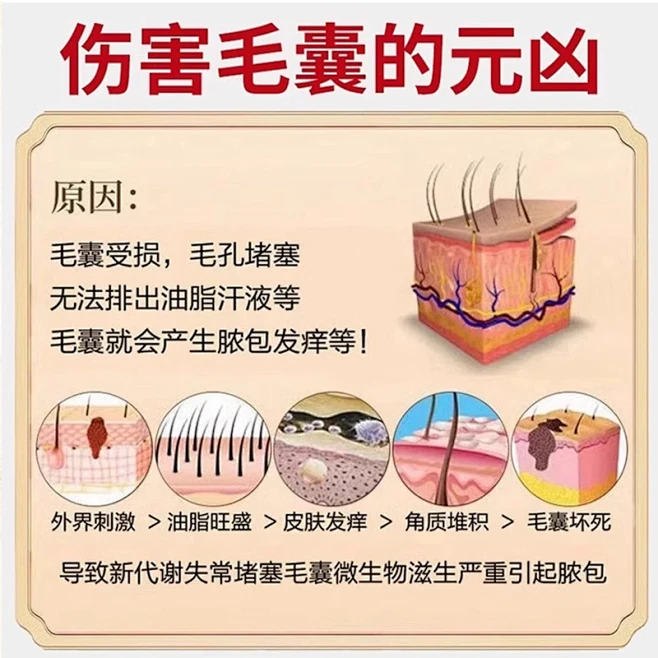 大腿腿上毛囊炎腿部毛孔堵塞疏通毛囊鸡皮肤医用退热凝胶喷雾剂JW,淘宝优惠券,粉丝福利购,淘宝优惠卷
