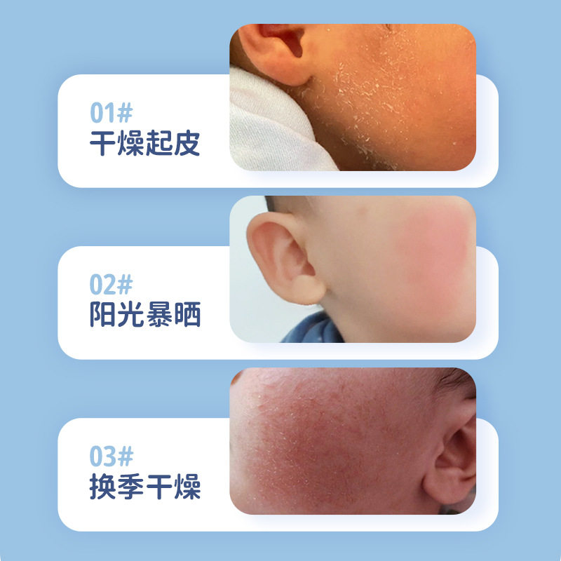 儿童金盏花面膜3-12岁小女男孩宝宝专用水润肌肤面部护理补水保湿