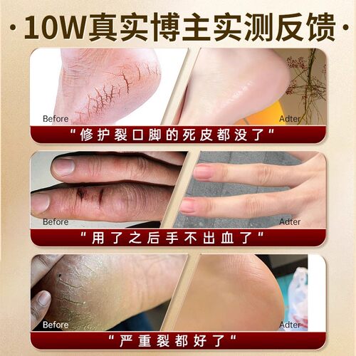 老式上海贝壳蛤蜊油嘎啦裂口歪歪油 膏脚后跟护手霜蚌壳棒棒油 - 图2