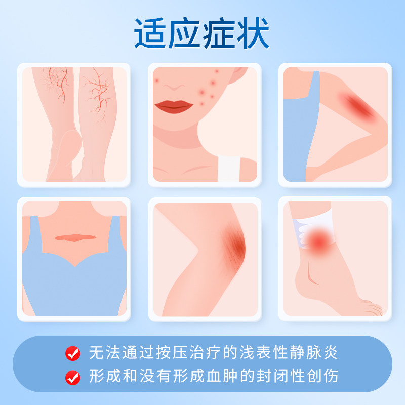 喜辽妥美洲版多磺酸粘多糖软膏乳膏特强喜疗妥旗舰店痘印疤痕凝胶