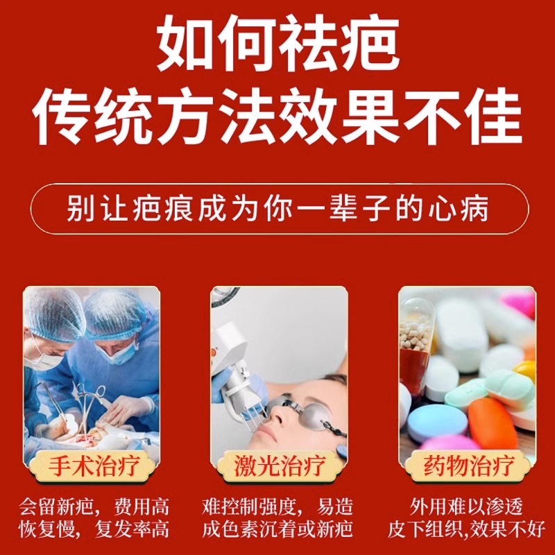 疤痕增生凸起去除胸前瘢痕疙瘩软化针修复油烫伤疤体质痒专用膏贴 - 图2