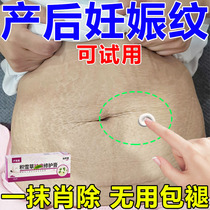 Geschen tattooed elimination of gestational tattooing to belly-partum postpartum repair cream Desalinated Scars for Scar Removal of Scar Fat Growth Ripples