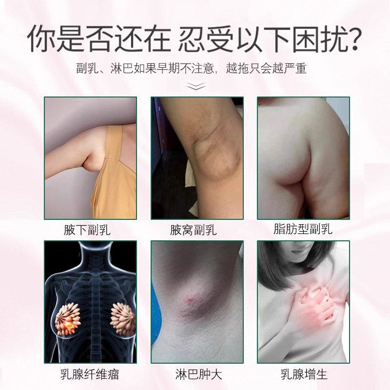 副乳消除药膏贴去副乳神疏通腋下赘肉淋巴肿大乳腺结节神器PA-图0