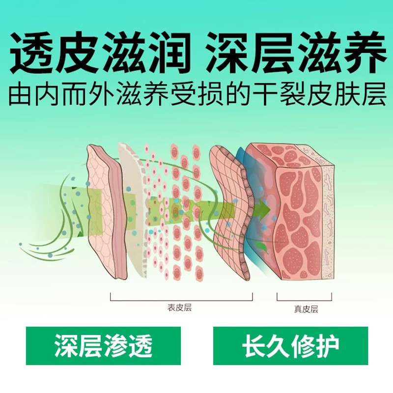 金泰康脚后跟干裂修复霜治干裂皲裂膏马油膏官方正品手脱皮护手霜 - 图3