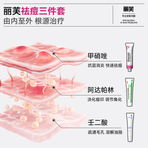 甲硝唑凝胶正品官方旗舰店甲硝唑凝胶祛痘消炎甲硝锉壬二酸凝胶15 - 图0