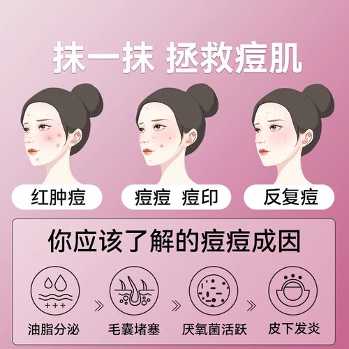 丽芙甲硝唑凝胶正品甲硝唑凝胶祛痘甲硝锉凝胶甲峭唑凝胶祛痘药膏 - 图0