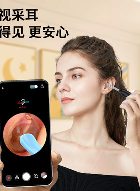 空盒子速发无线WIFI可视掏耳勺高清内窥镜采耳工具一整套 掏耳神