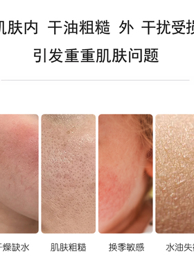 官方正品-医知康舒缓水-实体同款