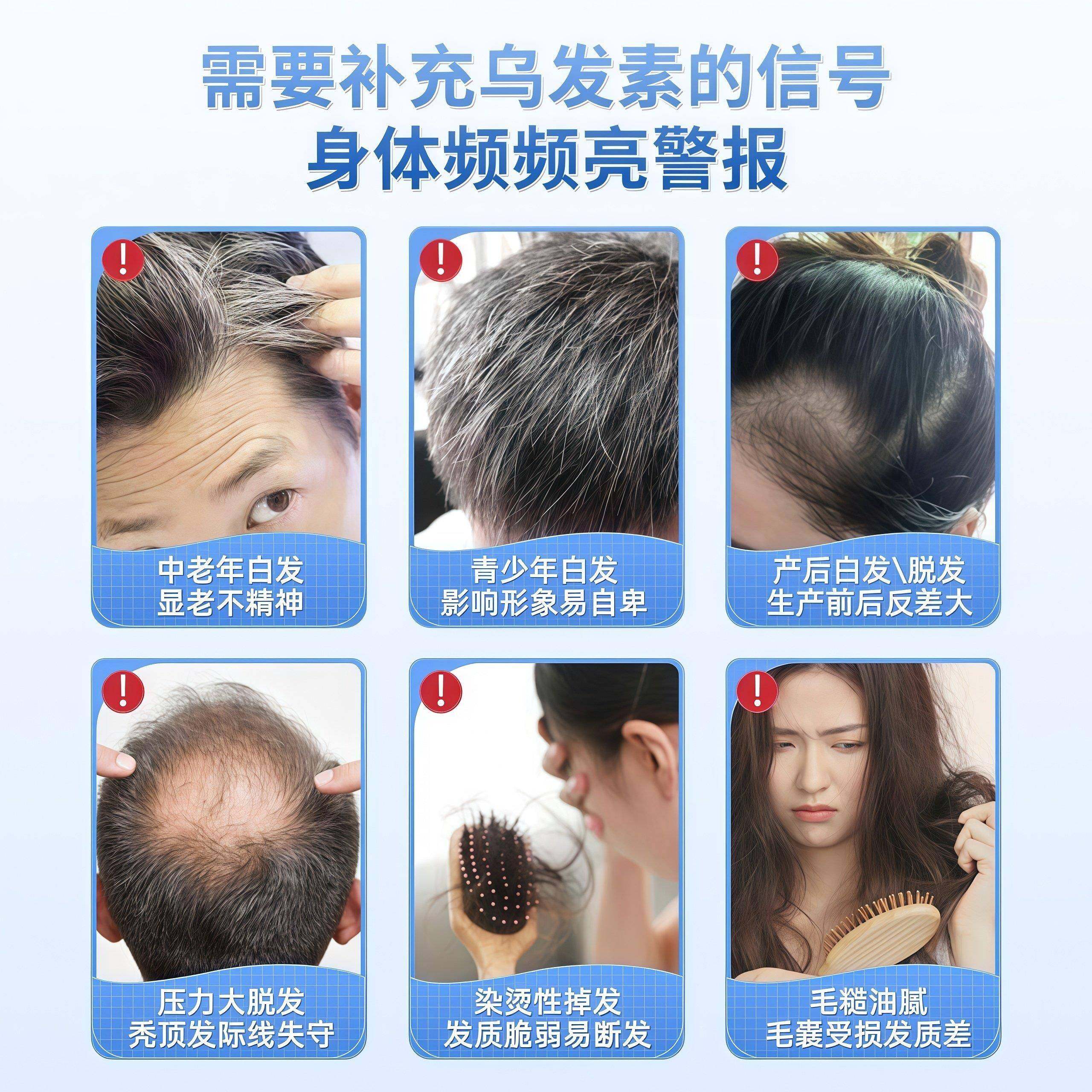 东康乌发素恩黑发养护内调白发营养睿钦B族维生素发根黑男女通用,淘宝优惠券,粉丝福利购,淘宝优惠卷