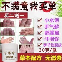 100 NET HAND ITCHING PEELING DRY CRACKED ITCHING CREAM HANDS AND FEET UP SMALL BLISTERS MEN AND WOMEN SEASONAL PEELING HANDS FULL OF MOSS CREAM