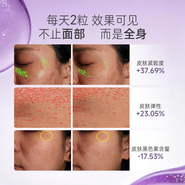 Beiyile Xu Jie'er ຮູບແບບດຽວກັນຂອງ sunscreen ຊ່ອງປາກ artifact ergothioneine photon filter ຢາຄຸມກໍາເນີດສໍາລັບການບໍລິຫານຊ່ອງປາກສໍາລັບການ brightening