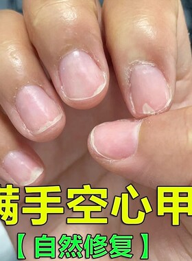 小红书推荐！甲床蹭蹭长！~