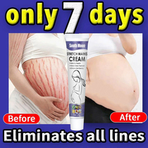 Stch mark cream Postpartum repair skin tightning repair cre