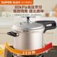 Supor pressure cooker household explosion-proof safety pressure cooker gas open flame special official authentic product (spell)