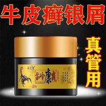 Miao Ling Condomus Psoriasis Psoriasis Special Scalp Ringworm Hitch Foot Skin Itching Dermatitis Eczema Anti-Itch