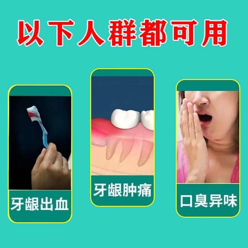 丁硼乳膏正品牙痛智齿牙疼消炎牙龈肿痛消炎药牙龈炎牙周炎口腔炎