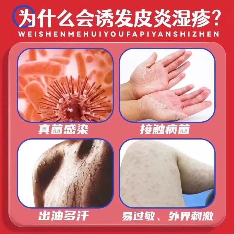 999皮炎平神经性皮炎外用膏治皮肤瘙痒湿疹止痒药过敏瘙痒症药膏,淘宝优惠券,粉丝福利购,淘宝优惠卷