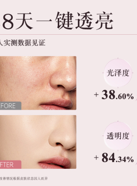 Yunth100%VC次抛精华液去黄