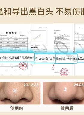 专柜发货！ilso一苏黑头水导出液
