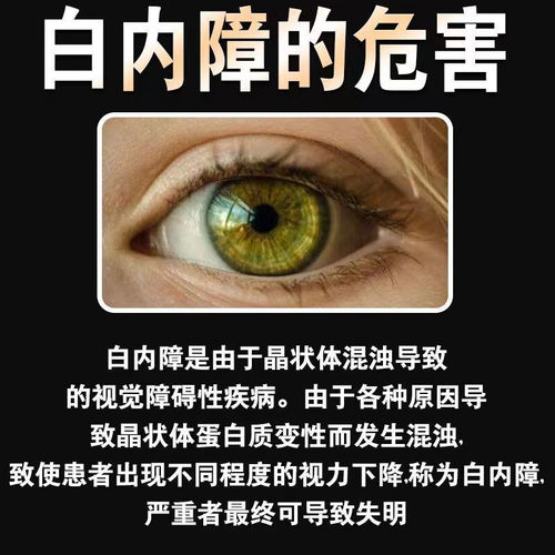 消朦片治疗白内障的眼药中老年白内障看不清视线模糊眼球混浊重影 - 图1