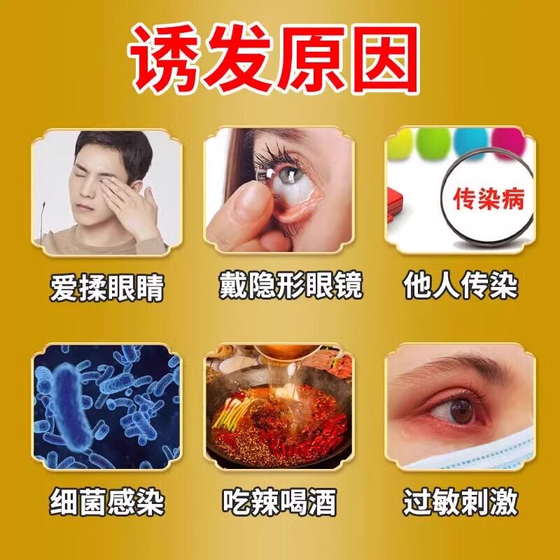 熊胆明目滴眼液结膜炎眼药水角膜炎滴眼液眼睛干涩疲劳模糊流眼泪