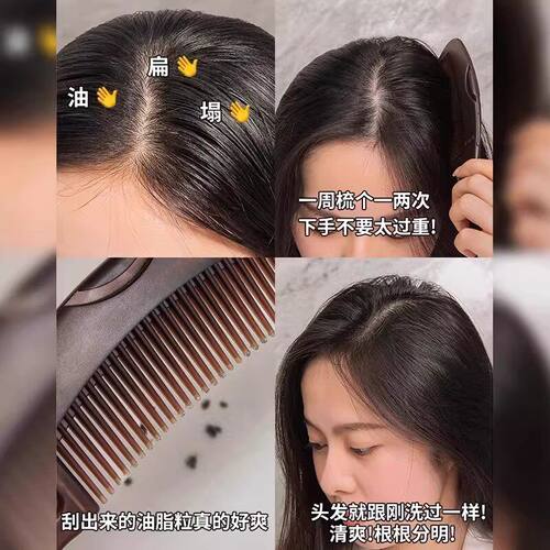 能量梳头皮空心梳油头第三四代免洗头气囊按摩去油脂清洁梳子皮屑 - 图2