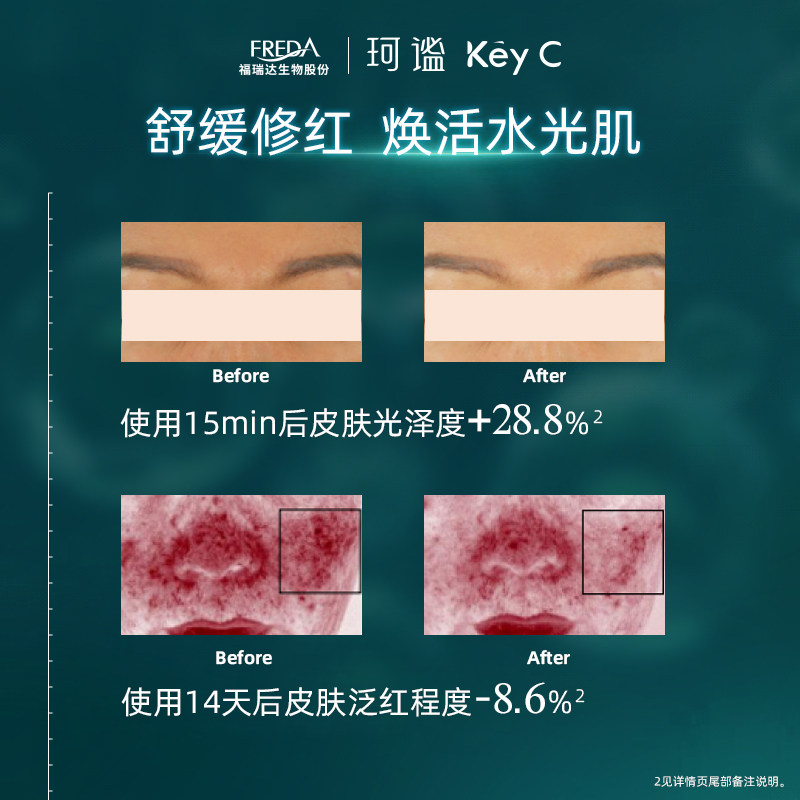 福瑞达 KeyC 珂谧 重组胶原蛋白修护贴面膜 5片 天猫优惠券折后￥9.9包邮(￥109.9-100)