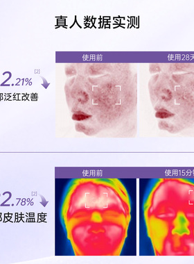 植物医生青刺果精华水爽肤水正品
