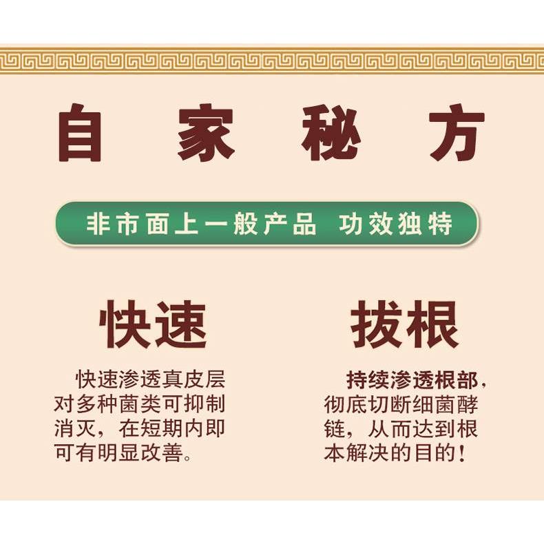 牛皮癣藓银屑病股廯湿疹止根去痒专用头癣治疗顽固性皮癣膏-图0