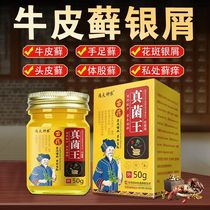 (Official) Miao Drug Fungus King Ointment Skin Itching Hand Ringworm Eczema Atopic Dermatitis Urticaria Cow