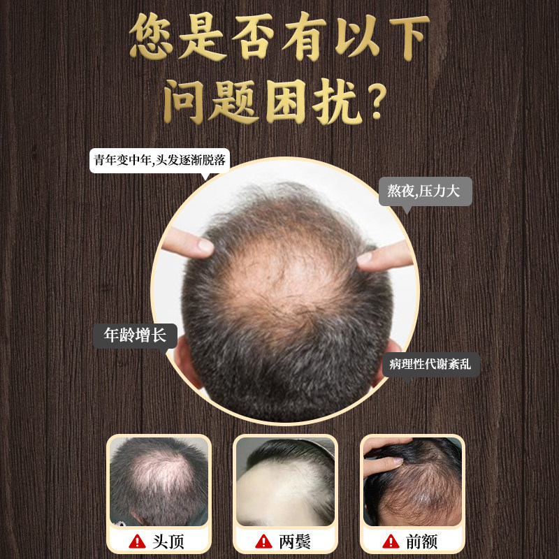 李时珍本草纲目白发脱发防脱固发七宝美髯丸止脱生发中药官方正品,淘宝优惠券,粉丝福利购,淘宝优惠卷