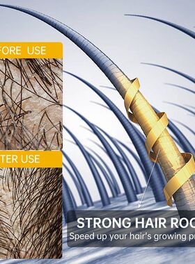好货2023 PURC Fast Hair Growth for Men Women Ginger Grow Hai
