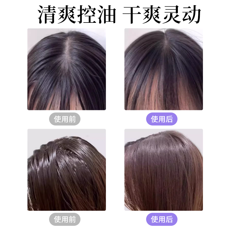 爱恩倍头发免洗湿巾擦头干洗刘海湿巾去吸油军训神器清洁蓬松懒人