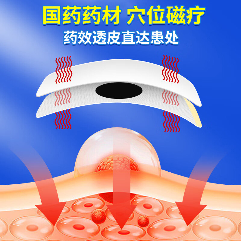 国药咽喉炎慢性咽炎贴咽扁非止咳化痰咽喉肿痛喉咙发炎官方正品xm