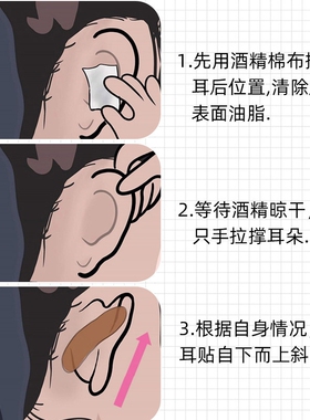 蝴蝶精灵耳贴强支撑隐形不痛女生固定招风耳矫正器立耳定型神器