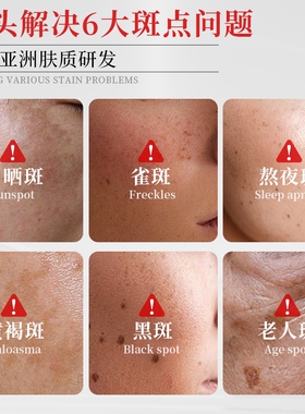 院线专研丨熊果苷乳霜TOP