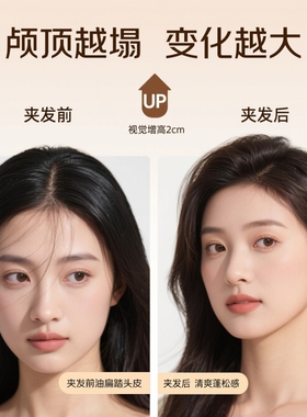 扬子玉米烫夹板头顶蓬松器