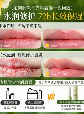 热销100W+儿童青少年保湿润唇膏