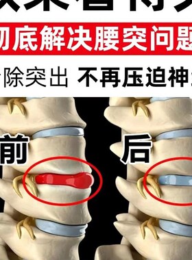 新品千人见证】腰椎疼痛r腰肌贴劳动损伤腰椎部位腰肌型劳动损伤