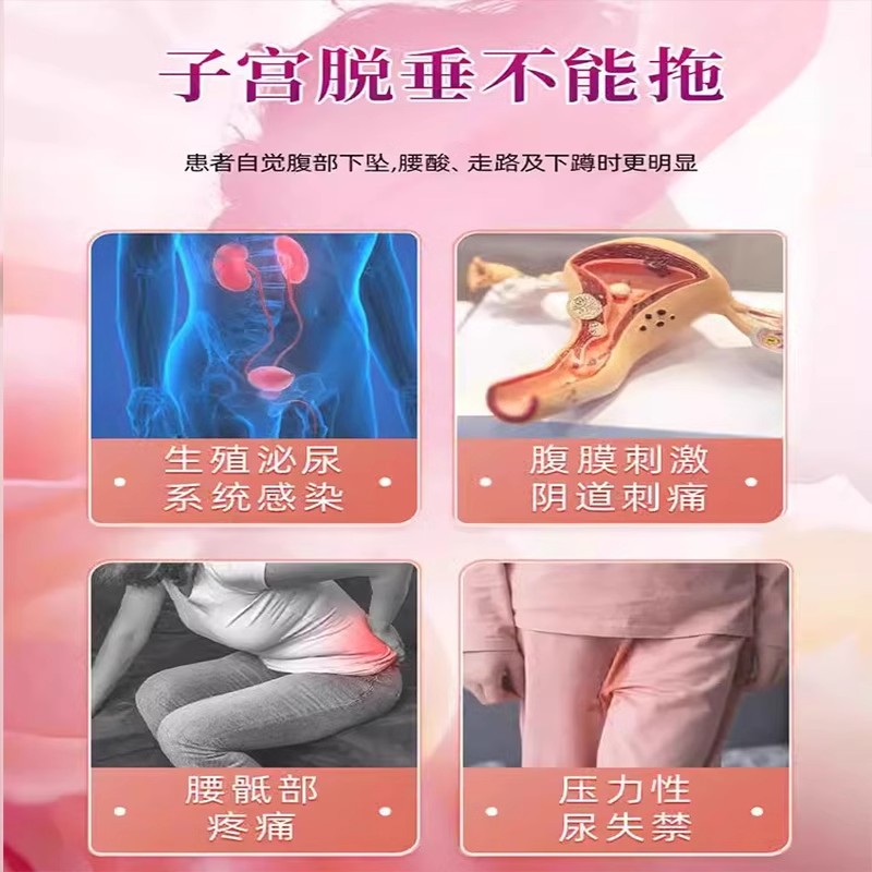 补中益气丸非北京同仁堂正品治子宫下垂妇科女性小腹坠痛子宫下坠