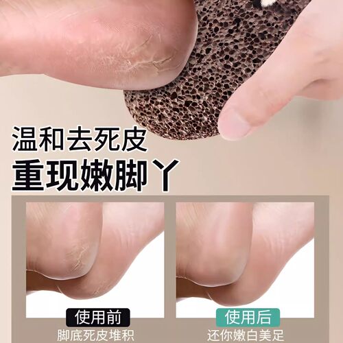磨脚石天然火山去死皮老茧家用修脚磨脚神器磨脚后跟搓脚浮石刮脚 - 图0