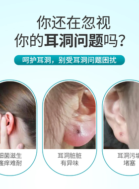 新品耳洞增生疙瘩护理耳康u液耳朵发焱专用清洁液疤痕增生凸起去
