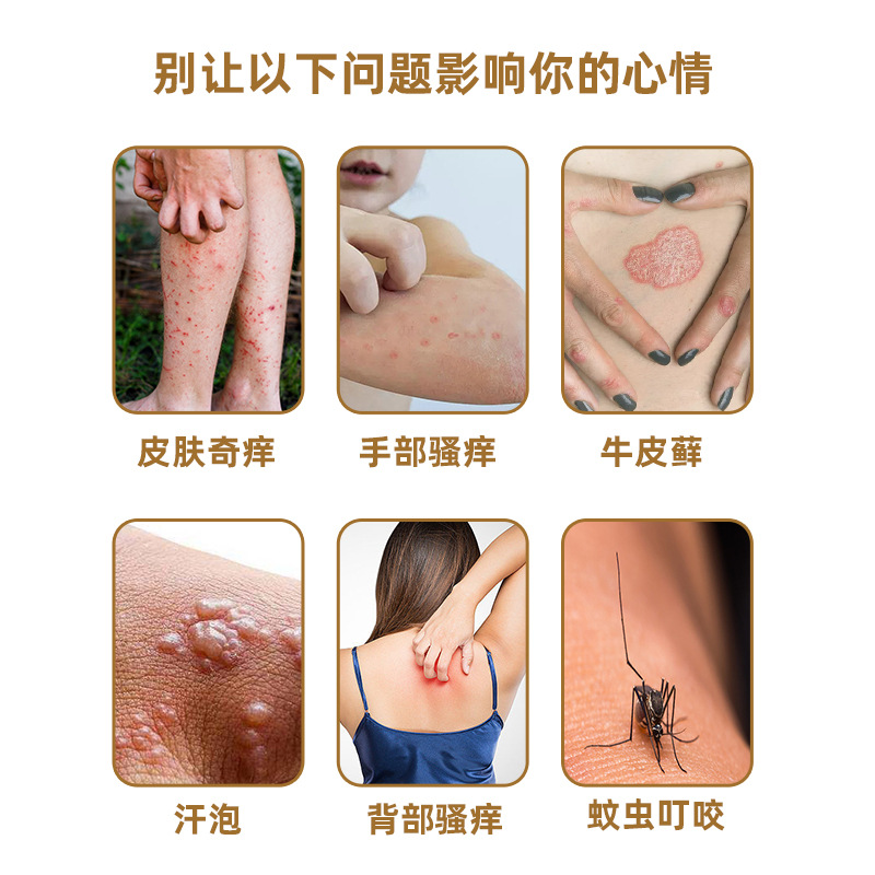 苗三叔香港式真菌王皮肤湿瘙痒软膏皮肤外用抑菌乳膏