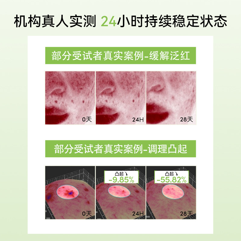 metoday双抗小绿盾姜黄素胶囊进口黑胡椒碱维生素D修护皮肤屏障,淘宝优惠券,粉丝福利购,淘宝优惠卷