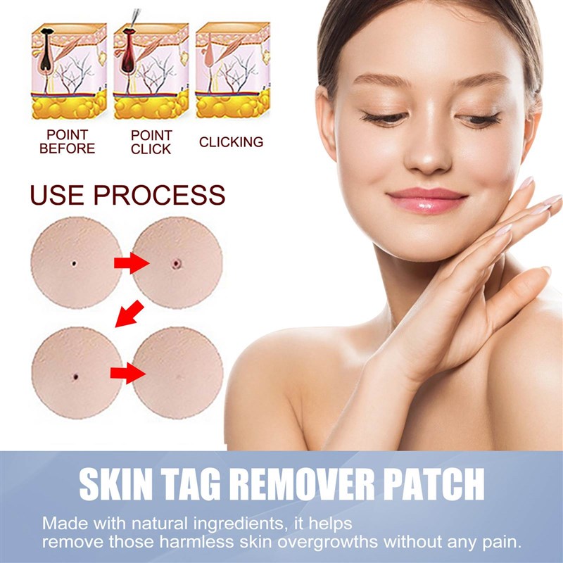 144Pcs Skin Tag Remover Patches Mole Wart Removing Sticker N - 图1
