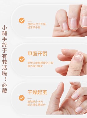 好货手指边缘护理油死皮倒刺指甲快速营养油起皮肉刺修复去角质软